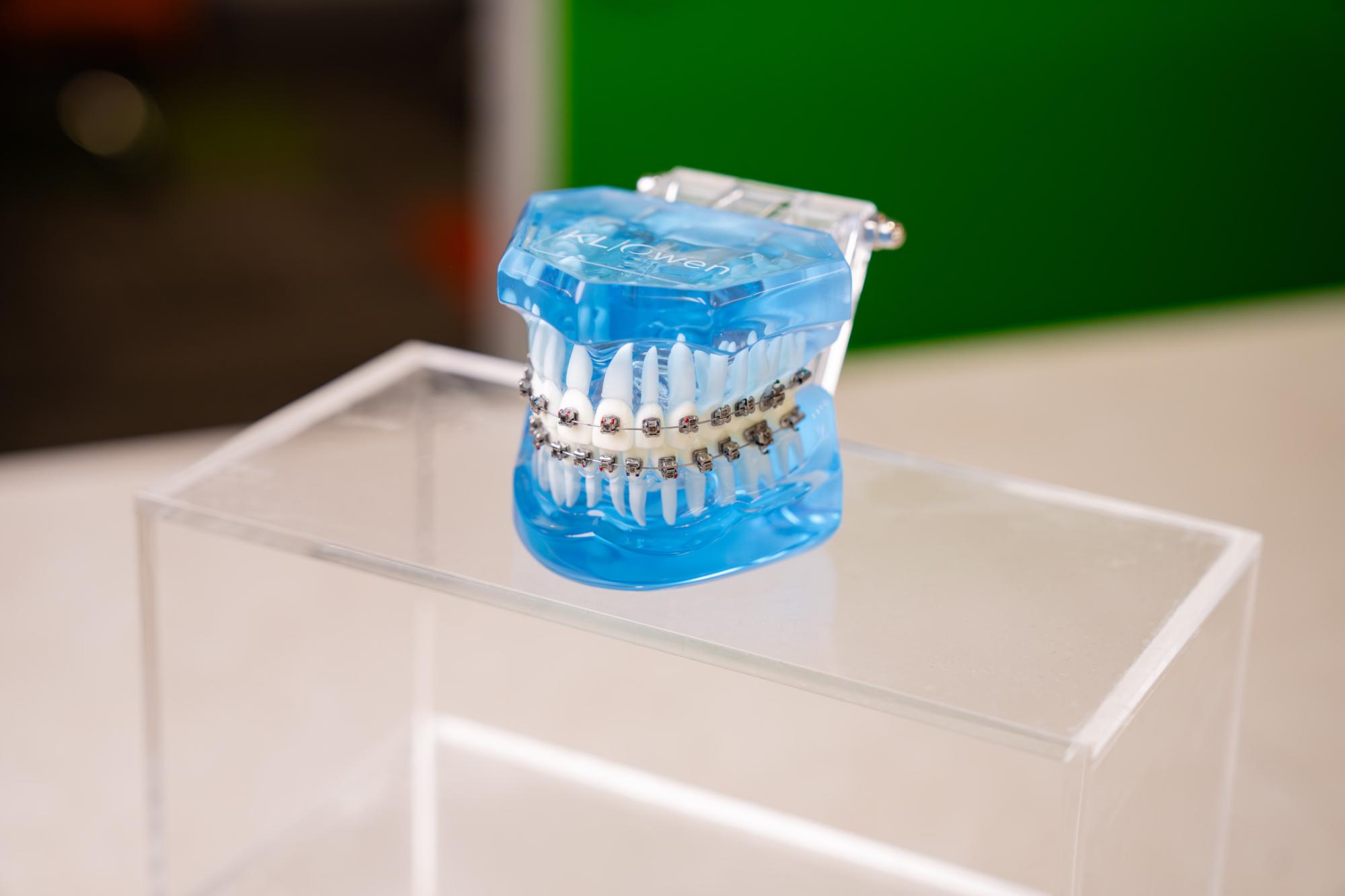 invisalign allen